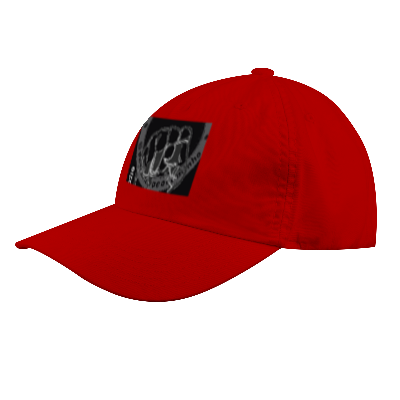 Nome do produto: Campanha de Bonés: \