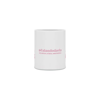 Nome do produto CANECA ROSA - SOMOS RAROS