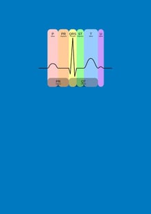 Nome do produtoECG