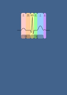 Nome do produtoECG