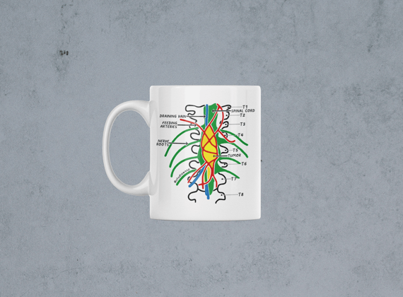 Caneca 
