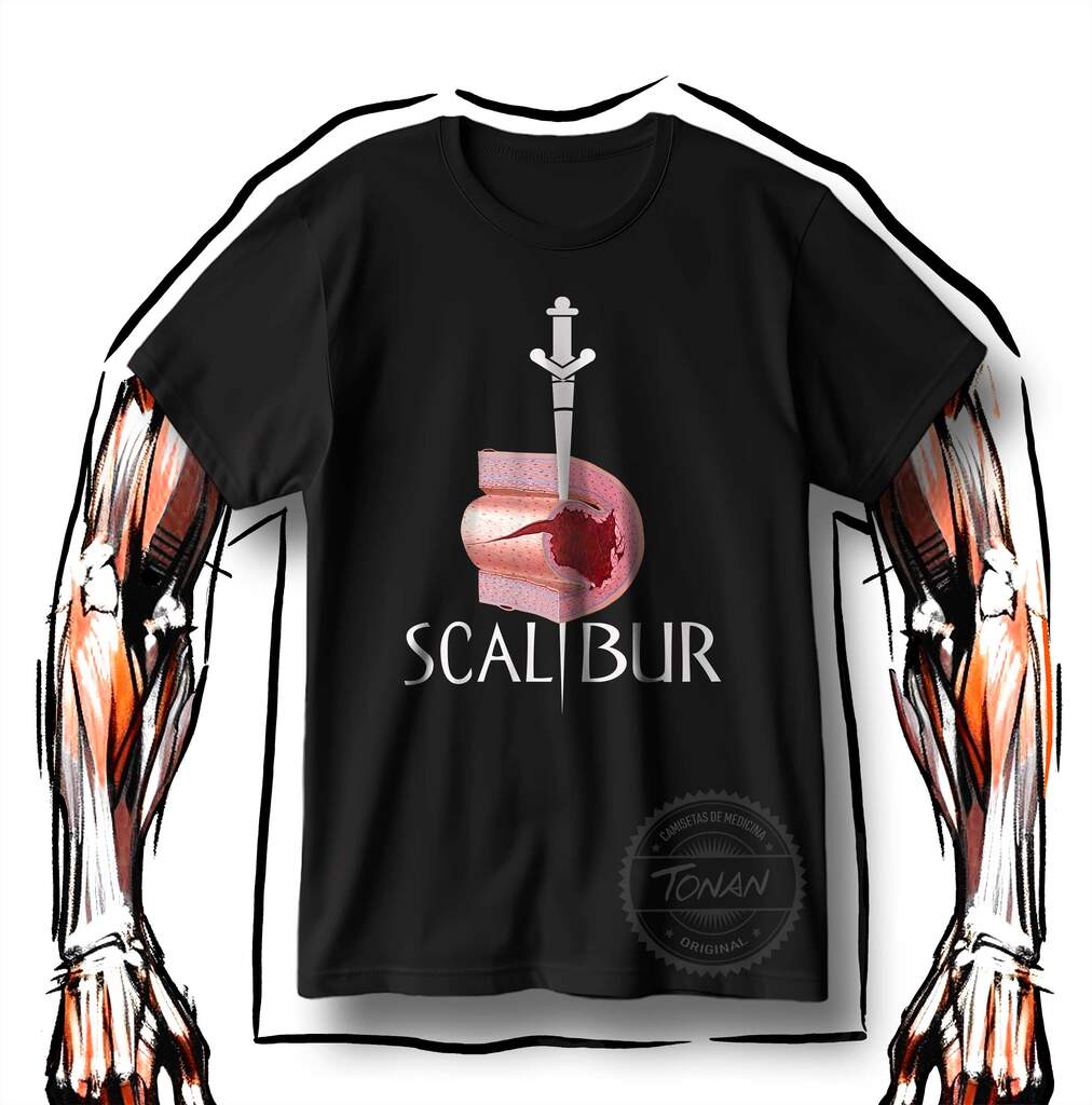 SCALIBUR - DISSECÇÃO ESPONTÂNEA DE ARTÉRIA CORONÁRIA 