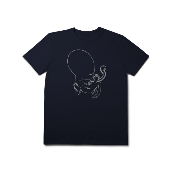 [Premium] SIGUR RÓS